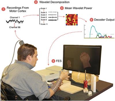 Dexterous Control of Seven Functional Hand Movements Using Cortically-Controlled Transcutaneous Muscle Stimulation in a Person With Tetraplegia